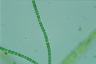 Anabaena