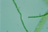 Anabaena