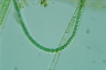 Anabaena