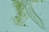 Chaetonotus zelinkai