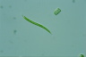 Euglena mutabilis