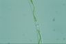 Spirogyra