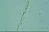 Spirogyra