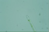 Spirogyra