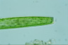 Pleurotaenium trabecula