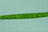 Pleurotaenium ehrenbergii