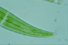 Closterium moniliferum