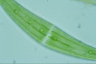 Closterium moniliferum