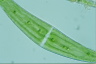 Closterium moniliferum