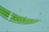 Closterium moniliferum