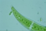 Closterium moniliferum