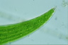 Closterium ehrenbergii