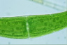 Closterium ehrenbergii