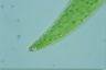 Closterium ehrenbergii