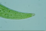 Closterium ehrenbergii