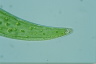 Closterium ehrenbergii