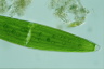 Closterium lunula