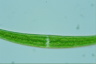 Closterium dianae