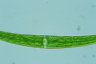 Closterium dianae