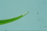 Closterium dianae