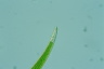 Closterium dianae