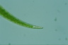 Closterium dianae