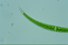 Closterium dianae