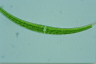 Closterium dianae