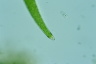 Closterium nematodes