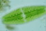 Netrium digitus