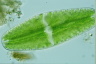 Netrium digitus