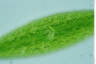 Netrium digitus