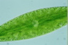 Netrium digitus