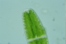 Netrium digitus