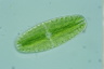 Netrium digitus