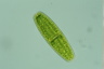 Netrium digitus