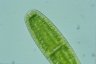 Netrium digitus