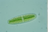 Netrium digitus