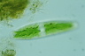 Netrium digitus