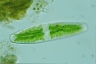 Netrium digitus