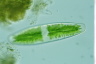 Netrium digitus