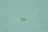 Cylindrocystis brebissonii