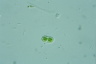 Cylindrocystis brebissonii