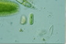 Cylindrocystis brebissonii