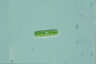 Cylindrocystis brebissonii