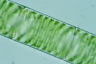 Spirogyra