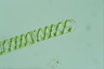 Spirogyra