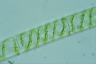 Spirogyra