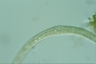 Spirostomum