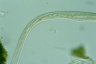 Spirostomum